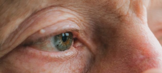 elderly eye problems